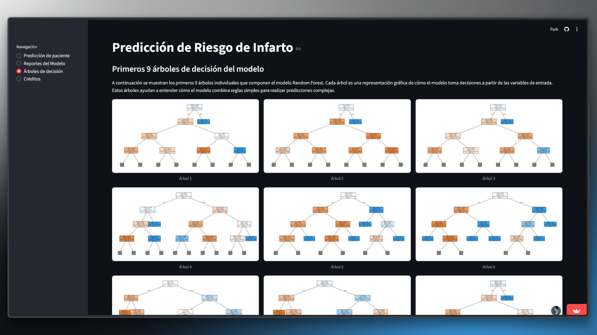 Model decision trees